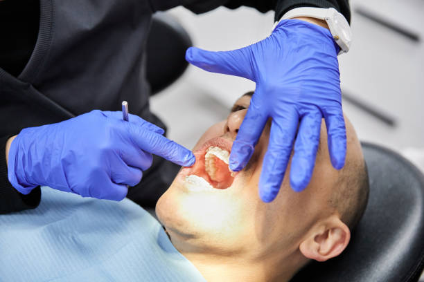 Best Emergency Broken Tooth Repair in Wheatland, CA